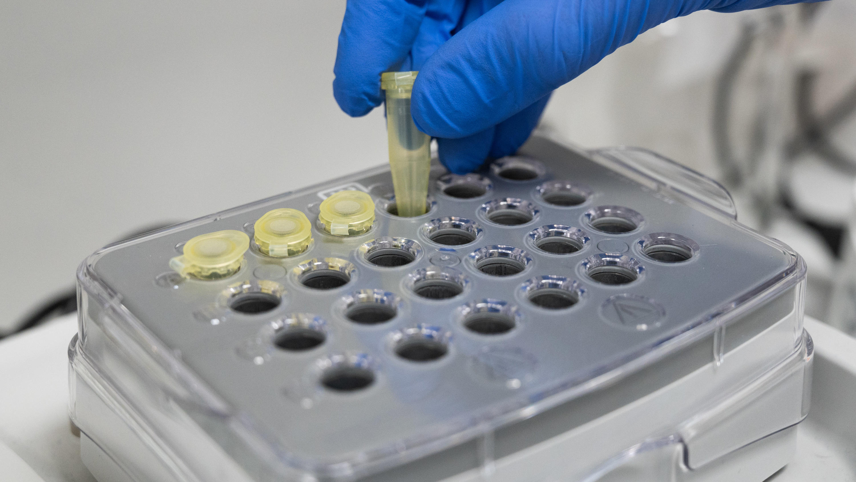 Entwarnung in Berlin: Verdacht auf Coronavirus hat sich nicht bestätigt Ein Laborant bestückt ein Schüttelapparat im Institut für Virologie an der Charité Berlin Mitte, in dem Untersuchungen zum Coronavirus laufen. Die chinesische Regierung hat die besonders schwer von der durch den Coronavirus ausgel