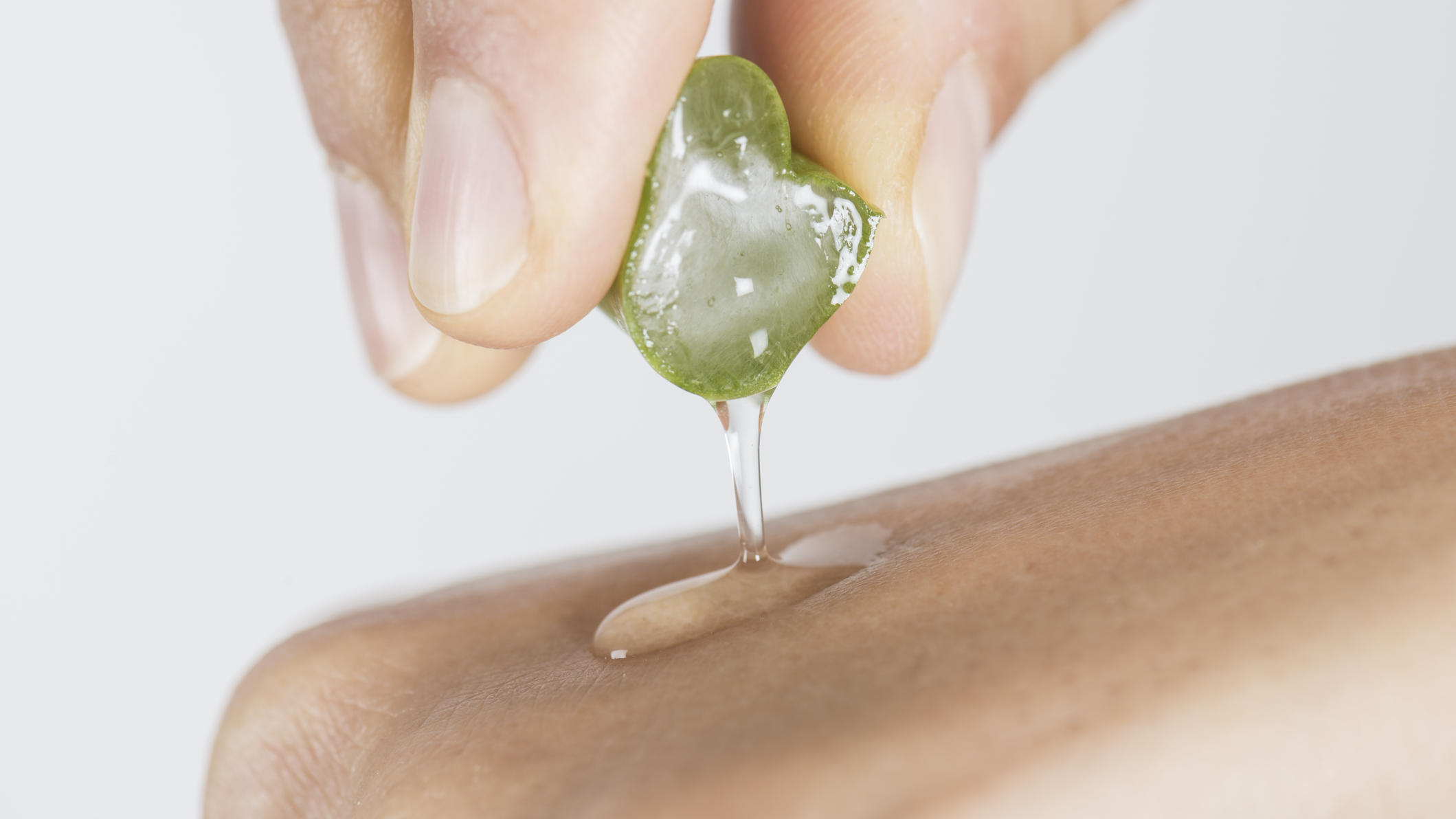 Welche Hausmittel helfen wirklich bei Sonnenbrand? Aloe Vera