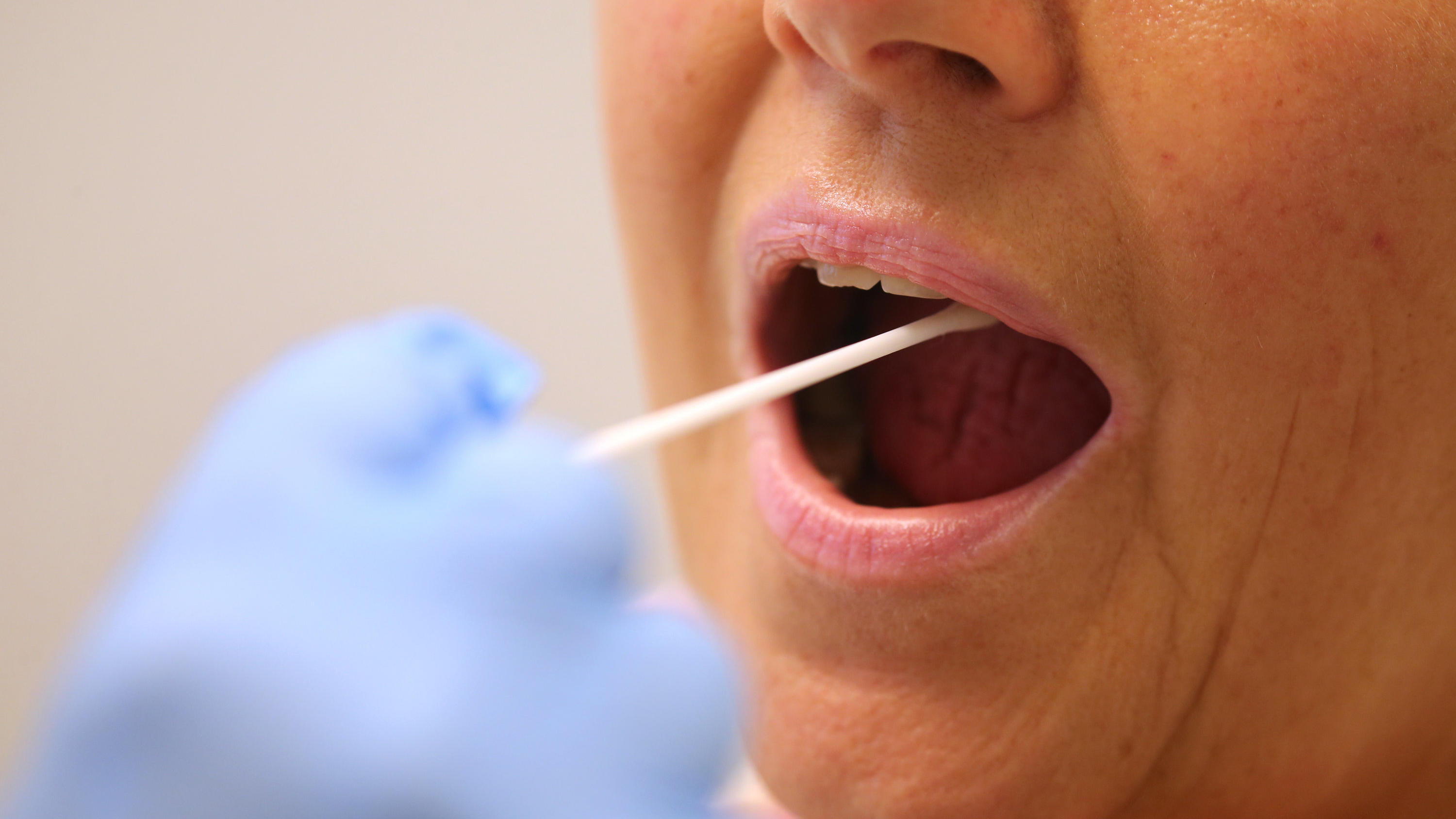 CORONAVIRUS-LIVETICKER - 13.554 Fälle: Corona-Neuinfektionen etwas unter dem Vorwochenstand ARCHIV - 30.06.2020, Bayern, Kaufbeuren: Ein Arzt nimmt in einer Hausarztpraxis mit einem Tupfer einen Abstrich bei einer Frau für einen Corona-Test. Es gibt verschiedene Möglichkeiten, eine Infektion mit Sars-CoV-2 festzustellen. Die gängigste Varia