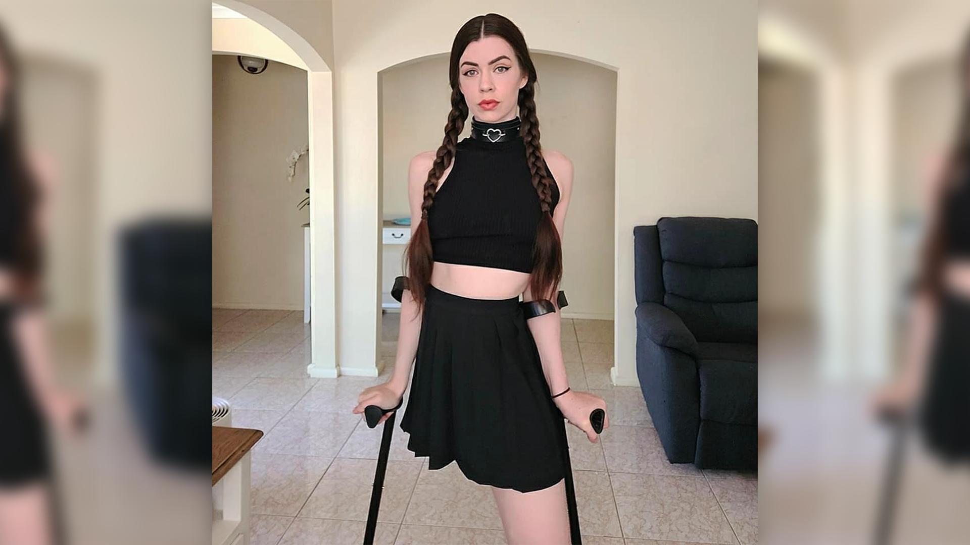 Model mit nur einem Bein - Auf Social Media muss sie sich unglaublichen Anschuldigungen stellen Eine junge Frau mit nur einem Bein steht auf Krücken gestützt.