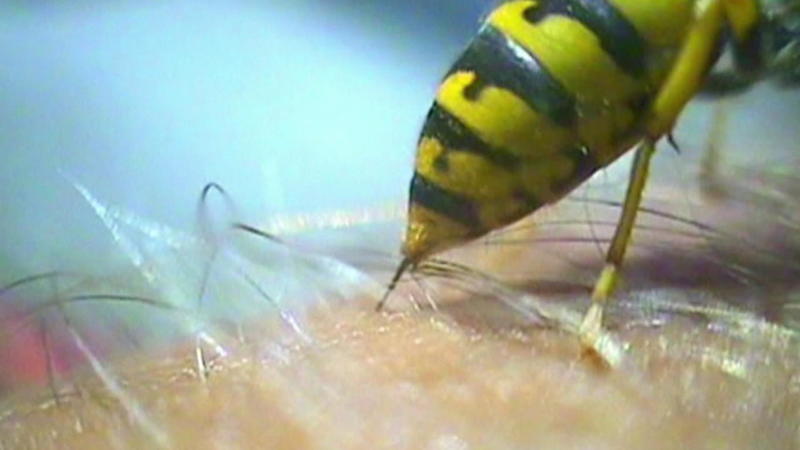 Insekten stechen gerade wie verrückt Mücken, Zecken, Bremsen: Welche sind gefährlich?