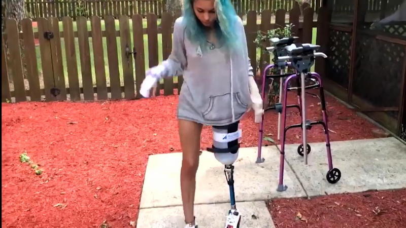 So mutig ist Paige Teenager erzählt vom Haiangriff