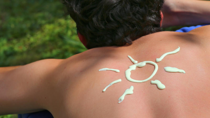 ILLUSTRATION - Ein junger Mann hat am 04.08.2015 in Kaufbeuren (Bayern) während eines Sonnenbades eine Sonne mit Sonnencreme auf den Rücken gemalt. Bei diesem Trend sehen Hautärzte rot: Junge Leute legen sich derzeit Schablonen auf die Haut - und las