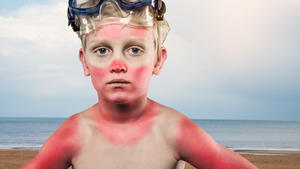 Sunburned boy wearing scuba mask standing in front of the sea