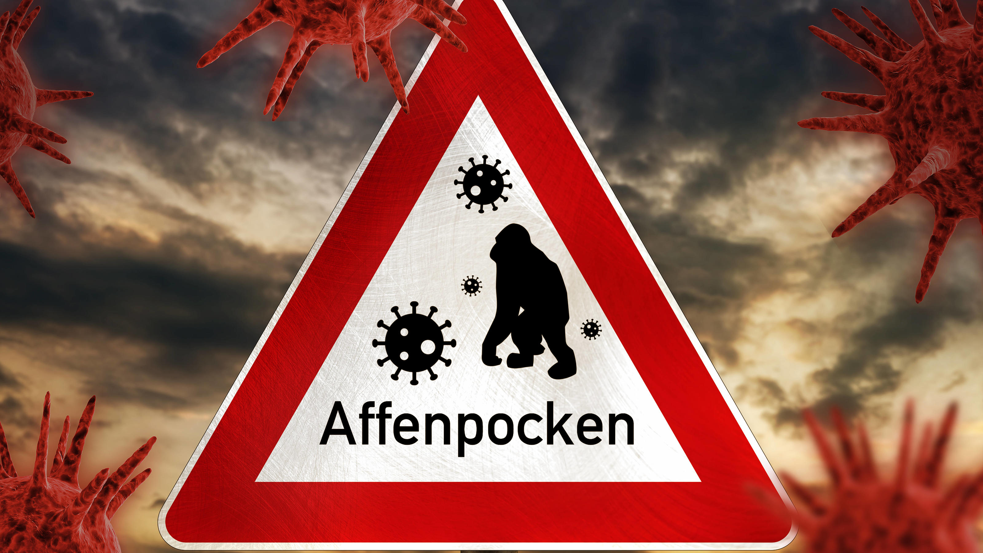  24 May 2022: Warning sign with inscription monkey pox, monkey pox PHOTOMONTAGE *** Warnschild mit Aufschrift Affenpocken, Affen Pocken FOTOMONTAGE