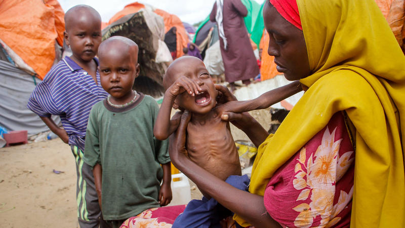 Somalia Hungersnot