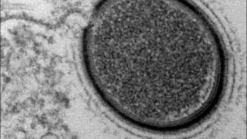 Virus Permafrost J.M. Claverie PNAS CNRS