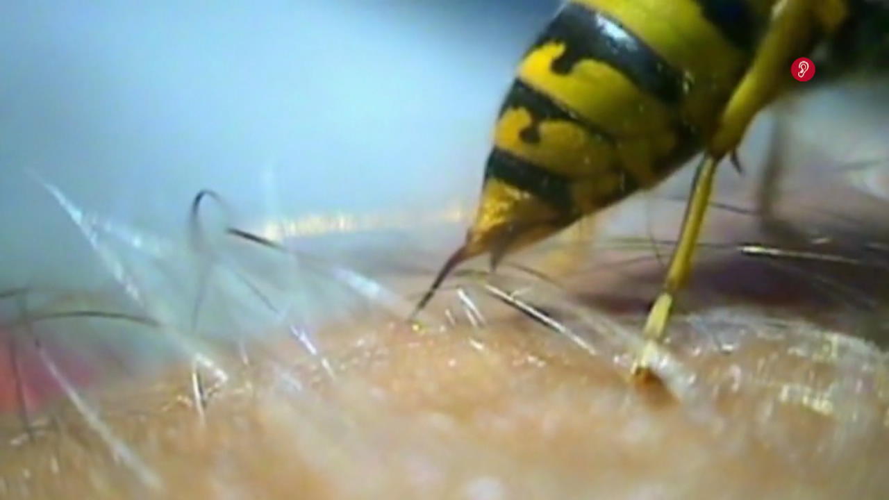 Wie Lange Dauert Ein Wespenstich nasas ani