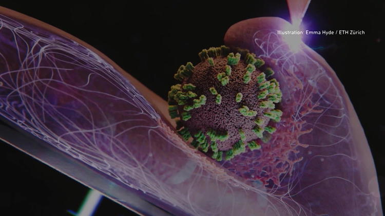 Super-Grippe breitet sich in Deutschland aus